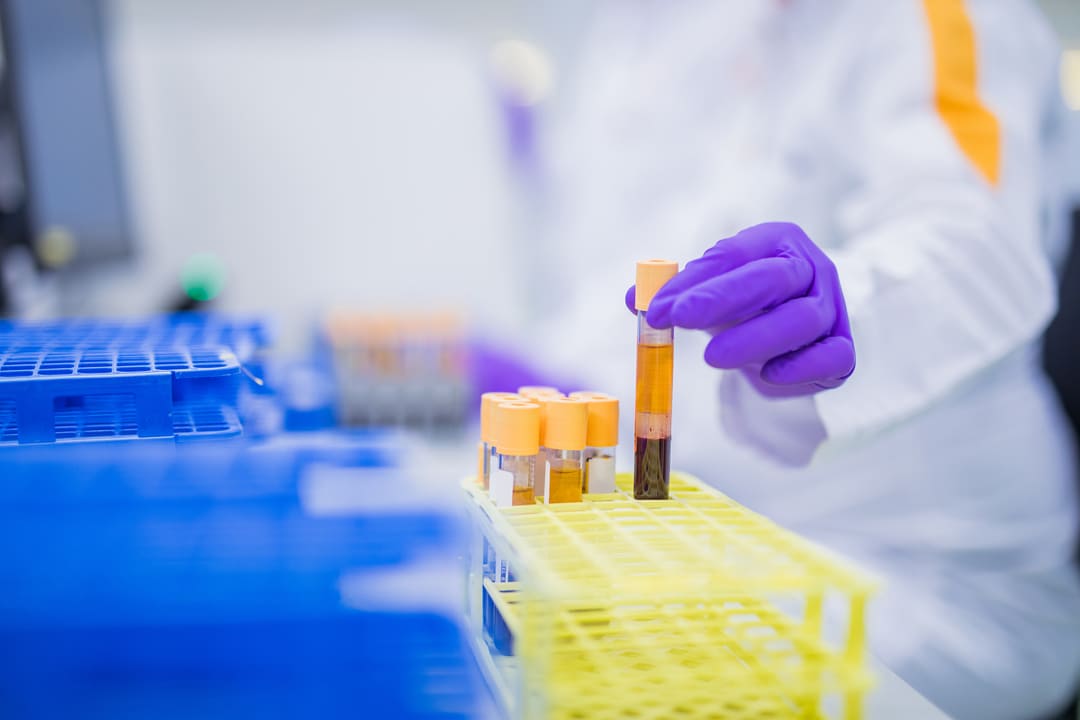 KCL Klinische chemie labdiagnostiek 1